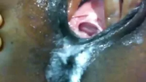 தோட்டி கூம்பு